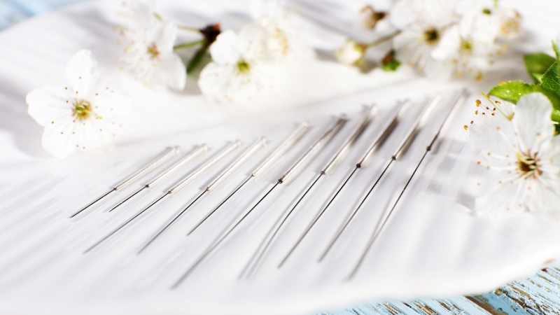 A row of acupuncture needles in different sizes for acupuncture for stress